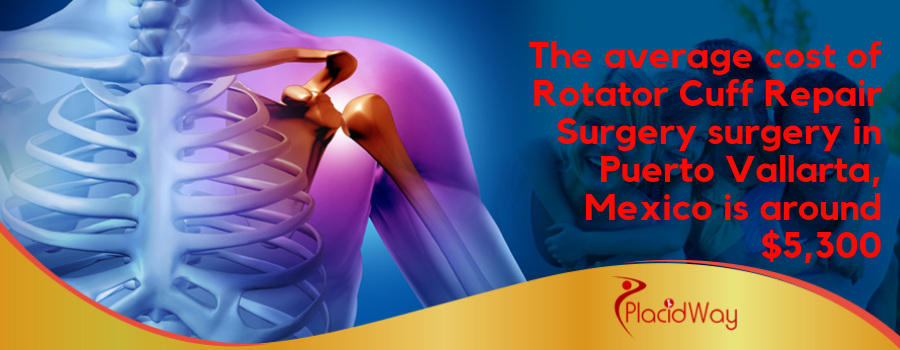 The average cost of Rotator Cuff Repair Surgery surgery in Puerto Vallarta, Mexico is around $5,300